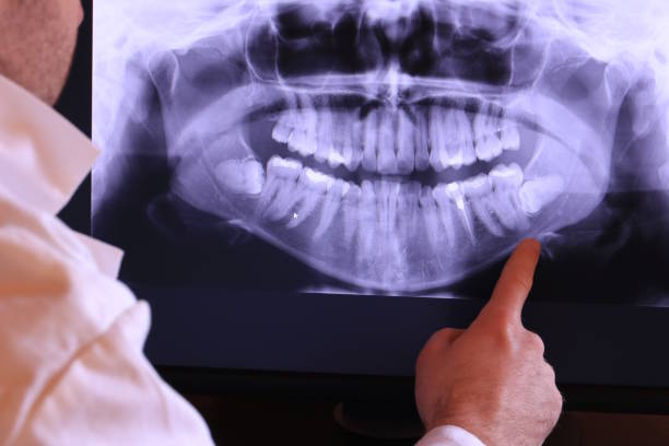 Best Emergency Dental Care for Broken or Chipped Teeth in Franklin Center, NJ