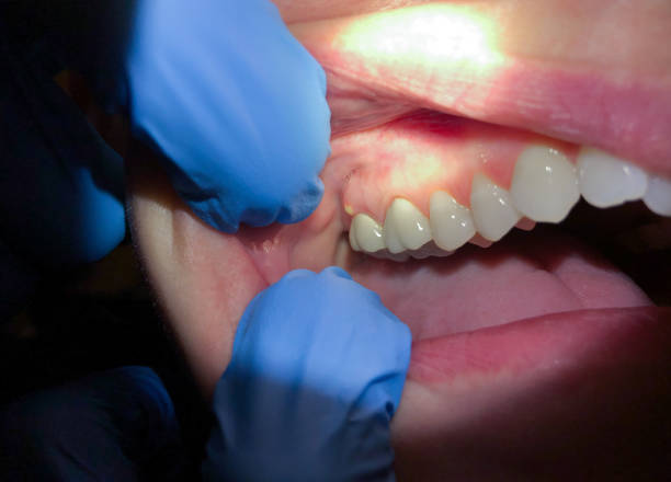Best Pediatric Emergency Dentist in Franklin Center, NJ